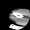 SPORK, NICO - 22.03.1976 - 02.08.2022 - CT obere Extremität - 17:51:17